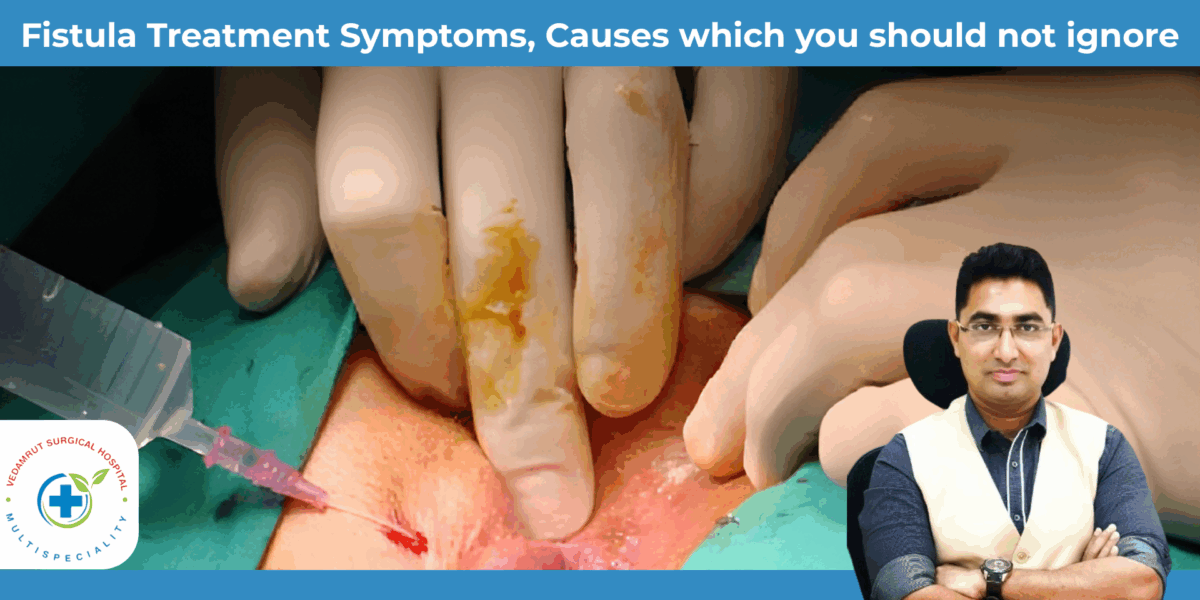 fistula treatment in thane