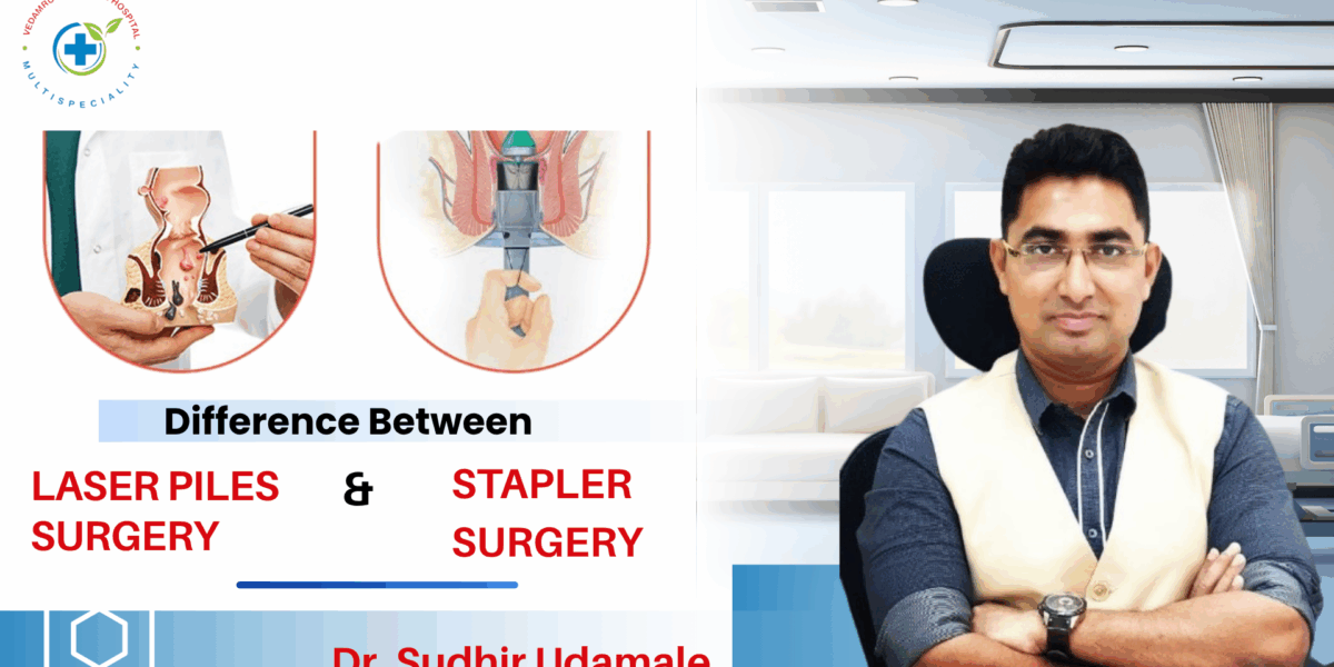 Laser Piles Surgery