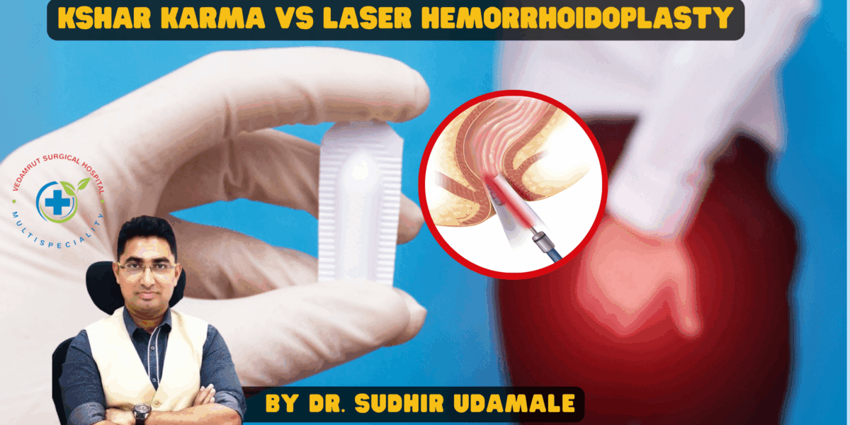 Kshar Karma vs Laser Hemorrhoidoplasty