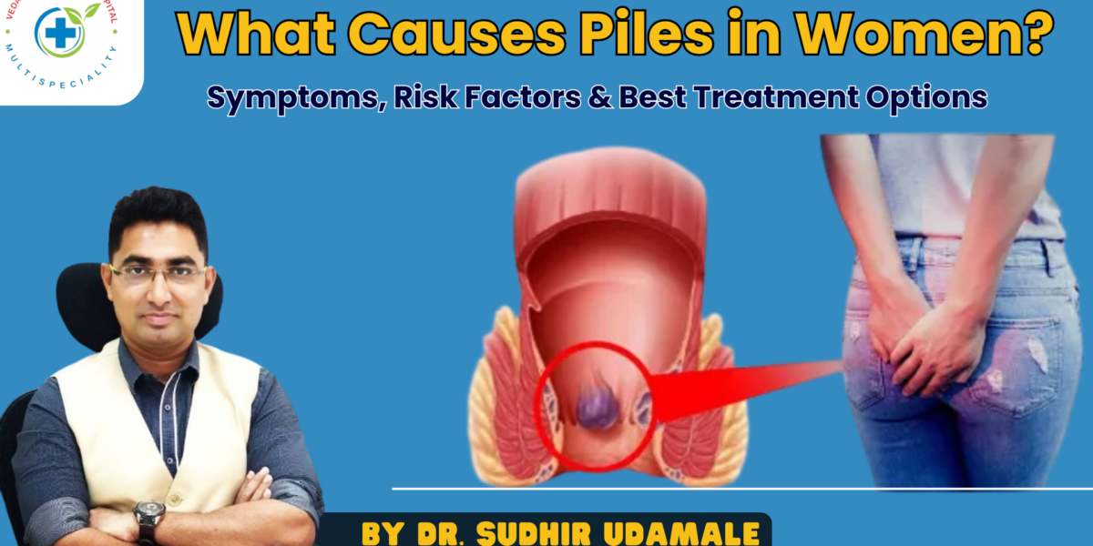 Piles in Women