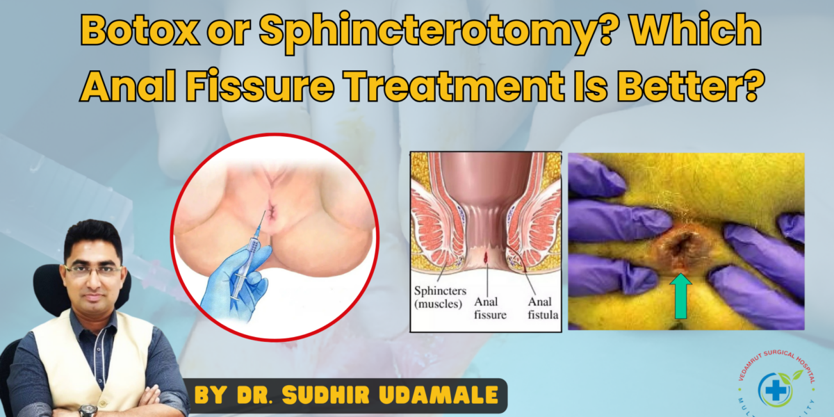 anal fissure treatment
