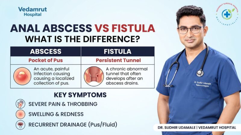 Anal Abscess vs Fistula