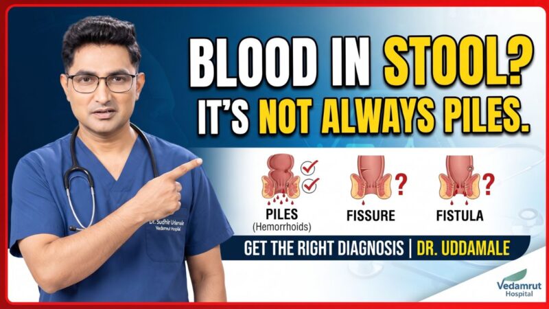 Blood While Passing Stool